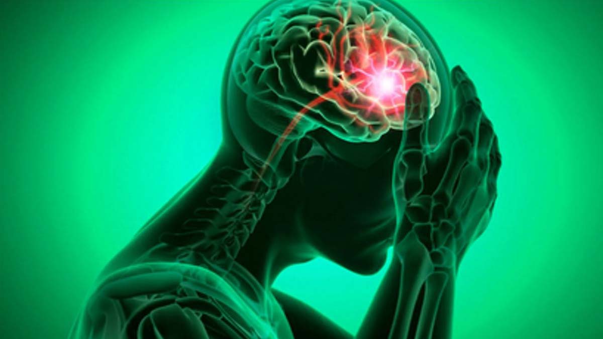 stroke risk